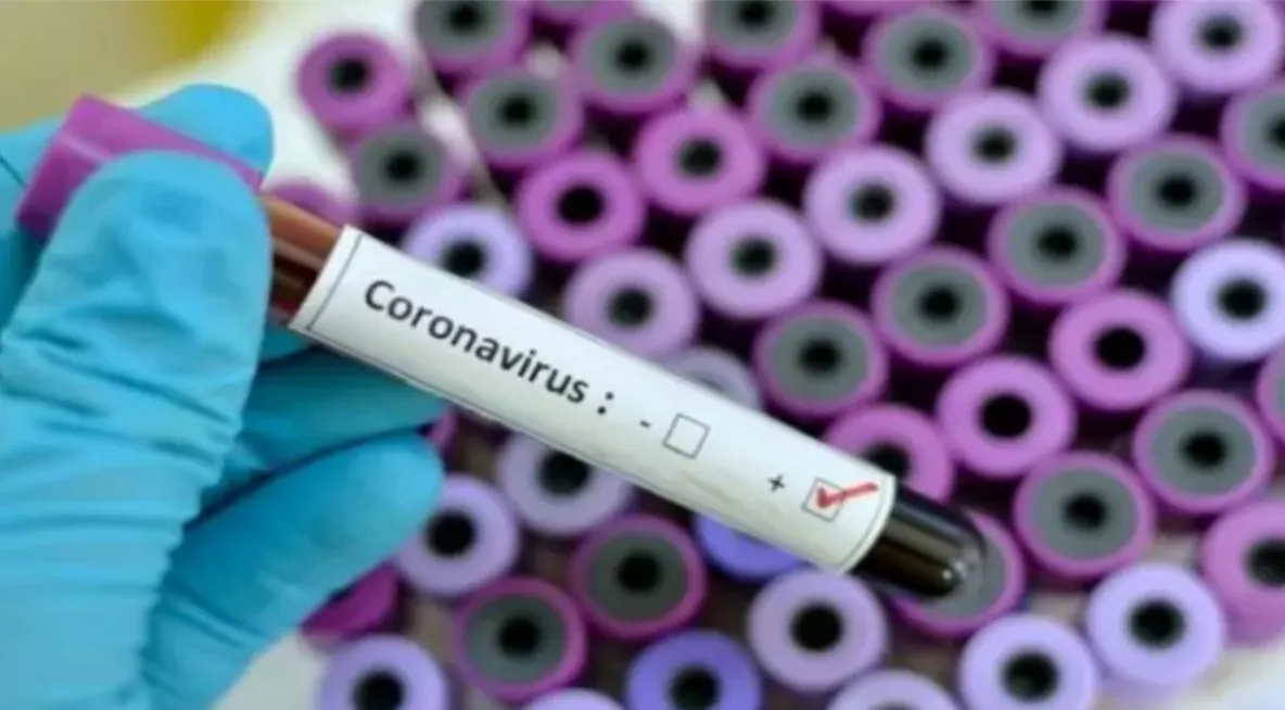 Cele 5 lucruri pe care trebuie să le știi despre coronavirus