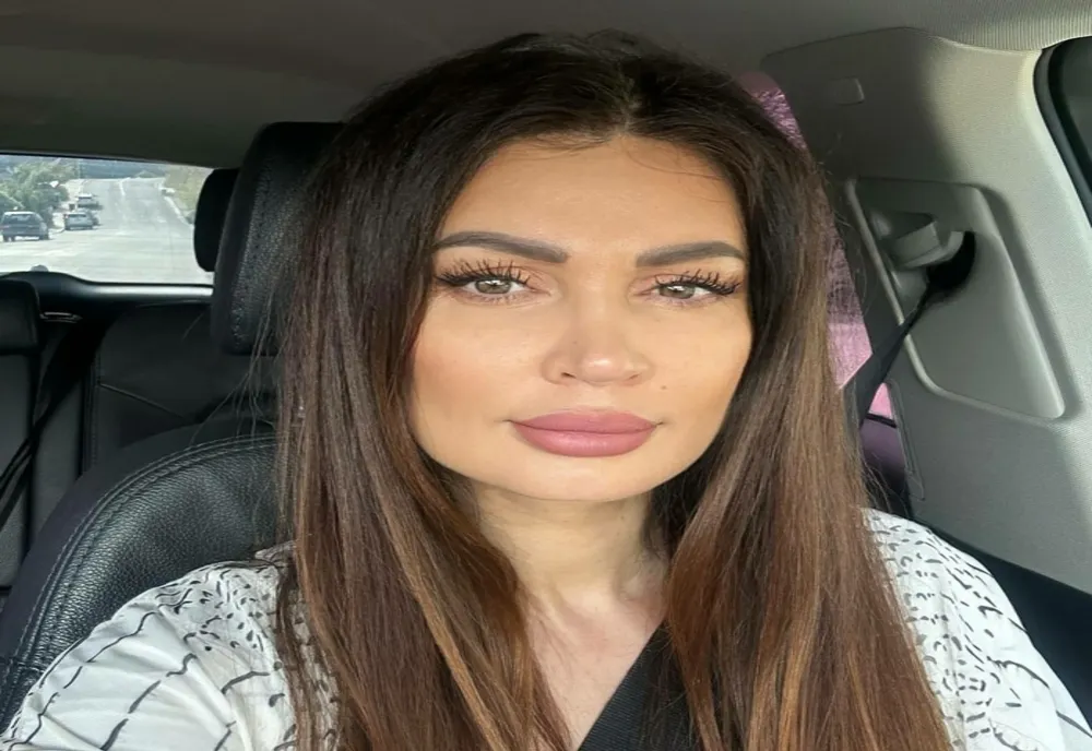 Nicoleta Luciu și-a făcut noi intervenții estetice. Cât au costat-o?