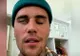 Justin Bieber, grav bolnav! Imaginile cu care și-a șocat fanii – VIDEO